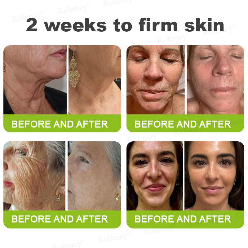 Made and shipped from the USA 💫Rolimey® Vita-A Retinol Shot Wrinkle-Lift Tightening cream - Last Day Promotion 70% OFF
