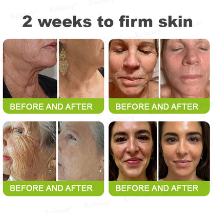 Made and shipped from the USA 💫Rolimey® Vita-A Retinol Shot Wrinkle-Lift Tightening cream - Last Day Promotion 70% OFF