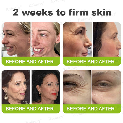 Made and shipped from the USA 💫Rolimey® Vita-A Retinol Shot Wrinkle-Lift Tightening cream - Last Day Promotion 70% OFF