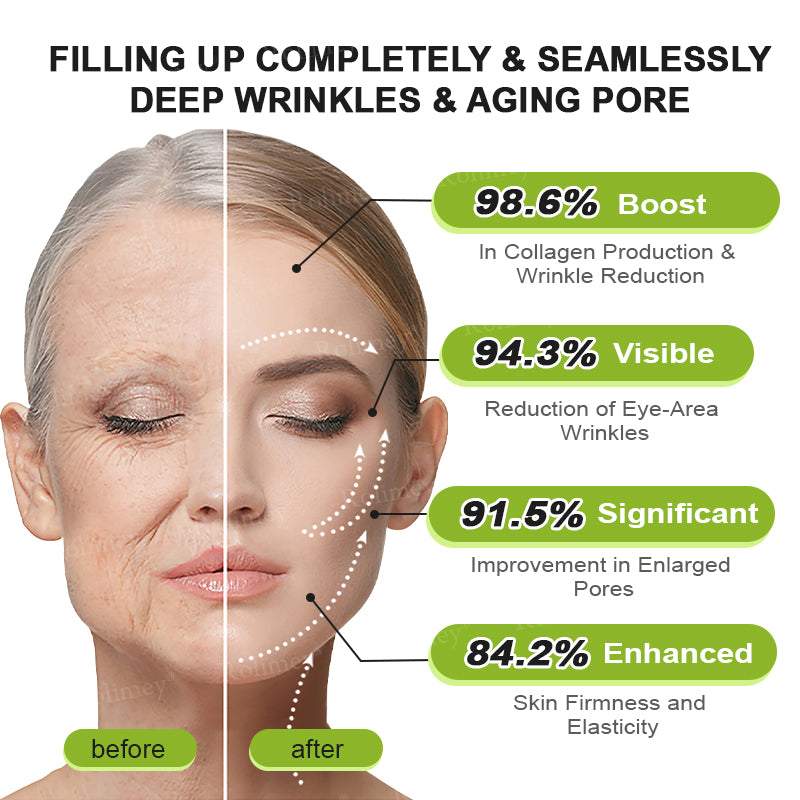 Made and shipped from the USA 💫Rolimey® Vita-A Retinol Shot Wrinkle-Lift Tightening cream - Last Day Promotion 70% OFF