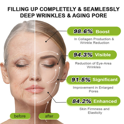 Made and shipped from the USA 💫Rolimey® Vita-A Retinol Shot Wrinkle-Lift Tightening cream - Last Day Promotion 70% OFF