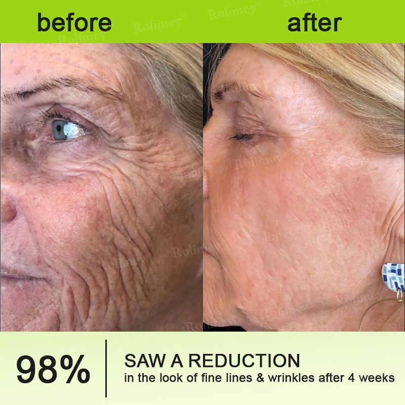 Made and shipped from the USA 💫Rolimey® Vita-A Retinol Shot Wrinkle-Lift Tightening cream - Last Day Promotion 70% OFF