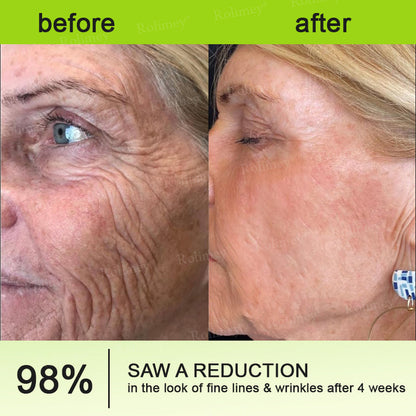 Made and shipped from the USA 💫Rolimey® Vita-A Retinol Shot Wrinkle-Lift Tightening cream - Last Day Promotion 70% OFF