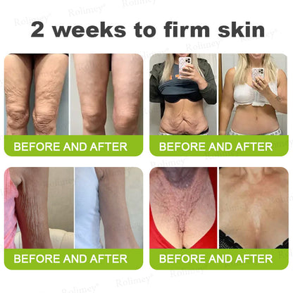 Made and shipped from the USA 💫Rolimey® Vita-A Retinol Shot Wrinkle-Lift Tightening cream - Last Day Promotion 70% OFF